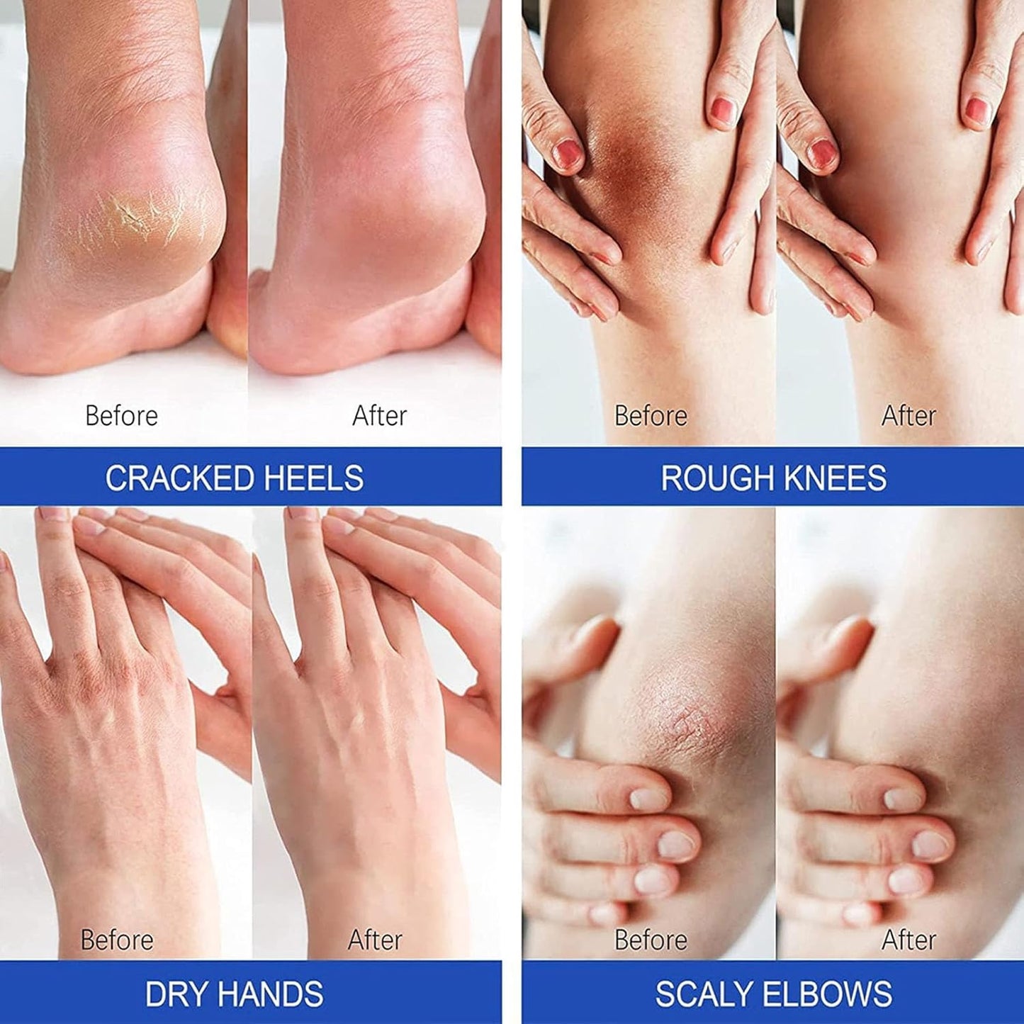 SOLEMEND™ Ultra-Repair Foot Cream